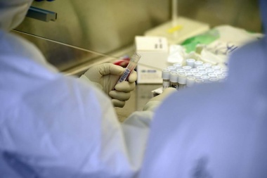 El SATHA traerá de Italia kits para detectar coronavirus en cualquier superficie