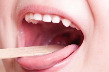 “No debemos estar preocupados por el Streptococcus, pero sí ocupados”