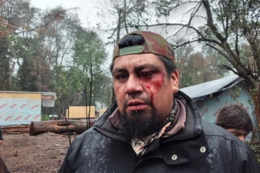 La APDH presentó una denuncia penal por la represión en la toma de La Angostura