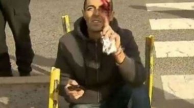 El Fiscal Delgado fue atropellado cuando llegaba a Comodoro Py en bicicleta