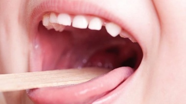 “No debemos estar preocupados por el Streptococcus, pero sí ocupados”