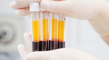 Legisladores porteños impulsan la donación de plasma