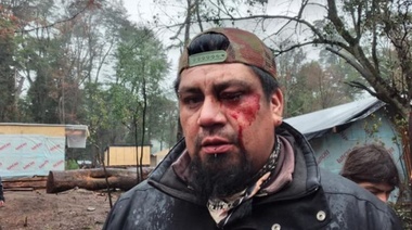 La APDH presentó una denuncia penal por la represión en la toma de La Angostura