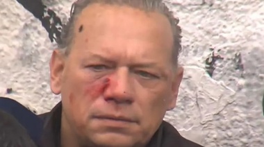 Jorge D'Onofrio recibe a la UTA tras la agresión a Berni